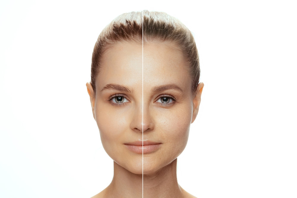 How to Even Out Skin Tone: 12 Proven Methods That Actually Work